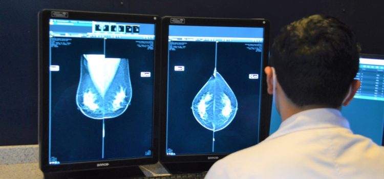 Suman 42 mil mastografías y 72 mil exploraciones de mama en la entidad